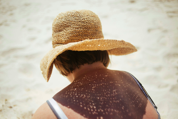 Sun Damage Skincare Routine: How to Reverse UV Effects on Skin