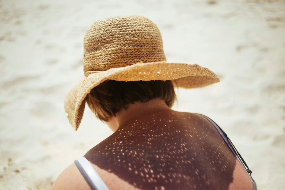 Sun Damage Skincare Routine: How to Reverse UV Effects on Skin
