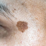 Why Your Dark Spots Aren’t Fading (And What Actually Works)
