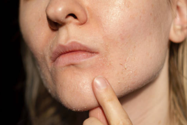 Dehydrated Skin vs Dry Skin: How to Tell the Difference (And Fix Both)