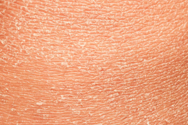 The Best Hydrating Serum for Dry and Dehydrated Skin