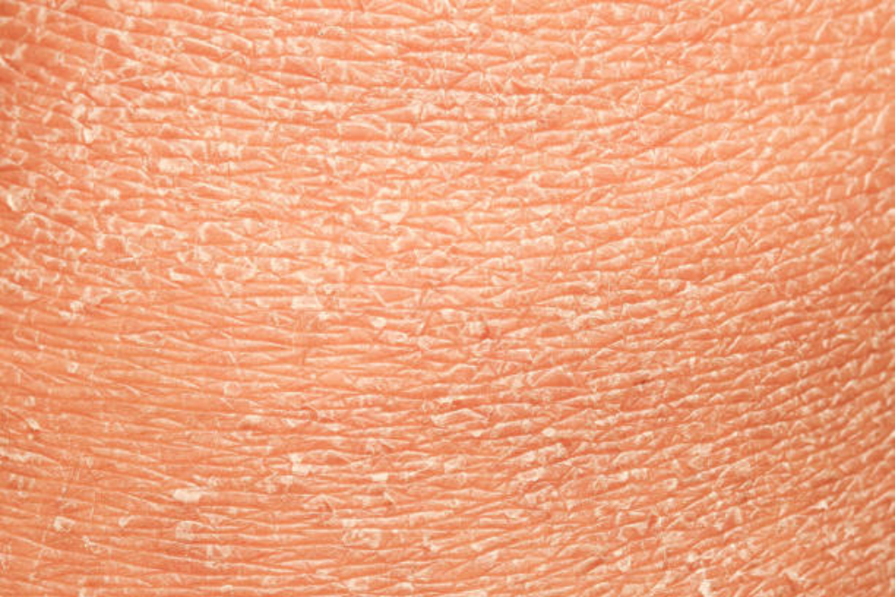 The Best Hydrating Serum for Dry and Dehydrated Skin