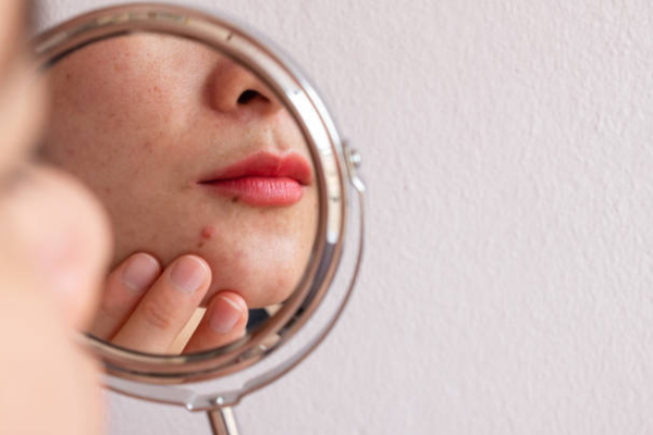 Best Skincare Routine for Damaged Skin Barrier (Step-by-Step Guide)