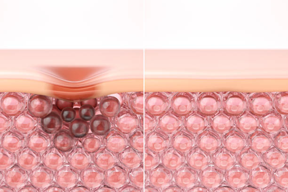 How to Get Rid of Dark Spots Naturally and Effectively in 2026