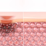 How to Get Rid of Dark Spots Naturally and Effectively in 2026