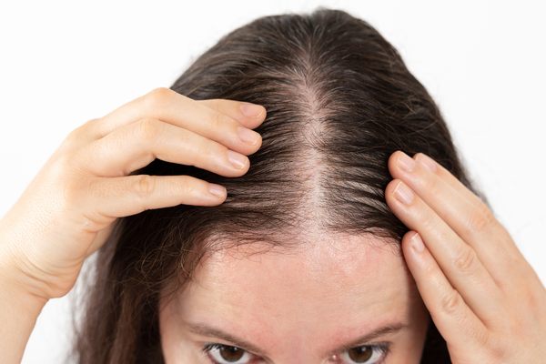 5 Proven Natural Ingredients for Hair Growth and How to Use Them