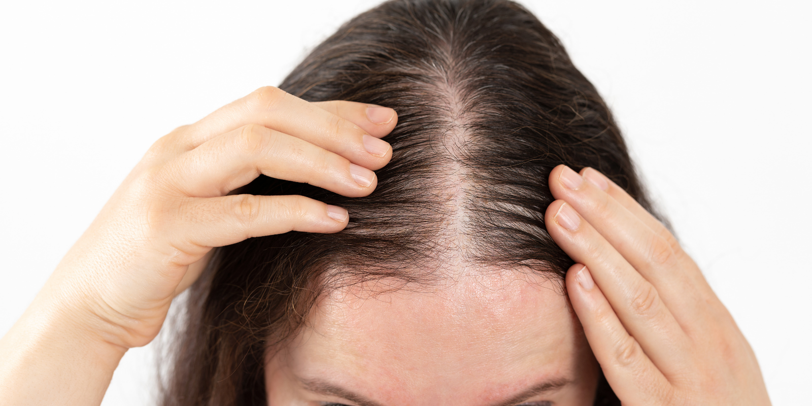 5 Proven Natural Ingredients for Hair Growth and How to Use Them