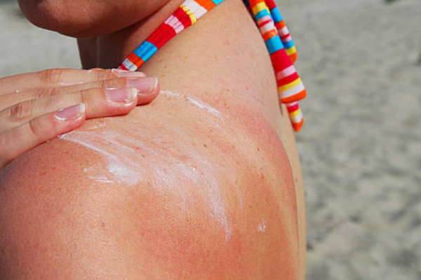 Dark Spots vs Sun Damage: How to Tell What’s Actually on Your Skin