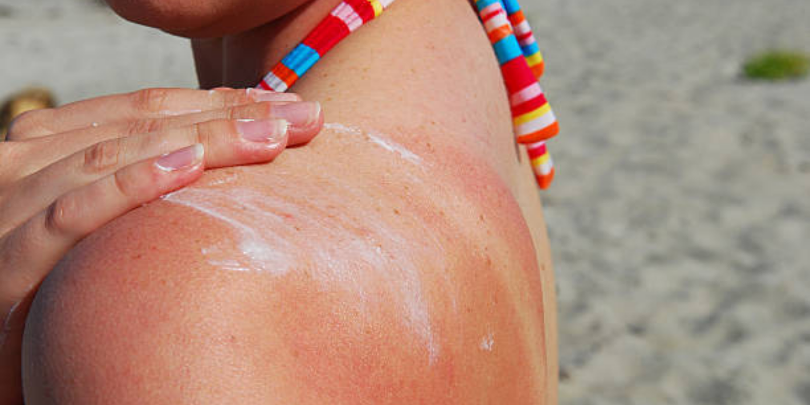 Dark Spots vs Sun Damage: How to Tell What’s Actually on Your Skin