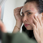 Adult Acne in Your 40s: Why It Happens Even If You Never Had Acne Before