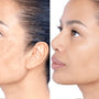 Dark Spots & Sensitive Skin: What Works + What to Avoid