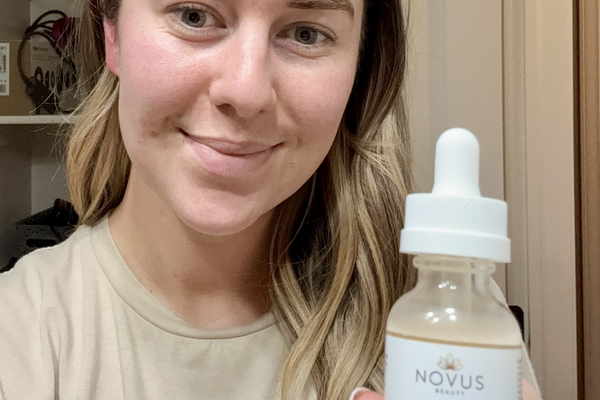 The Best Dark Spot Corrector for Sensitive Skin That Actually Works