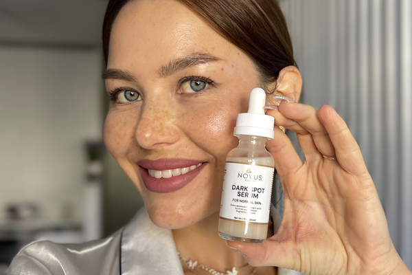 How to Fade Dark Spots Naturally (And Actually See Results)