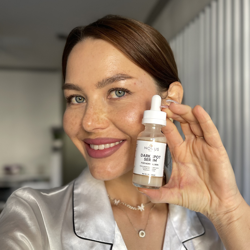 How to Fade Dark Spots Naturally (And Actually See Results)
