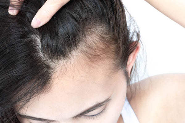 The Connection Between Your Scalp Health and Hair Growth