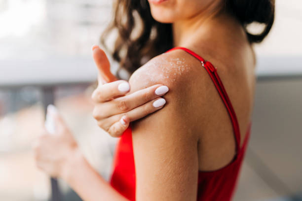 The Rise of Ectoin: The New Barrier-Protecting Power Ingredient