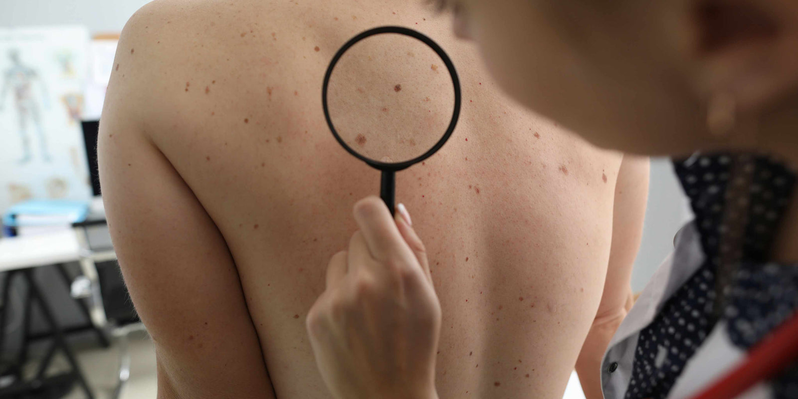 Laser vs Skincare for Dark Spots: What Dermatologists Don’t Always Explain