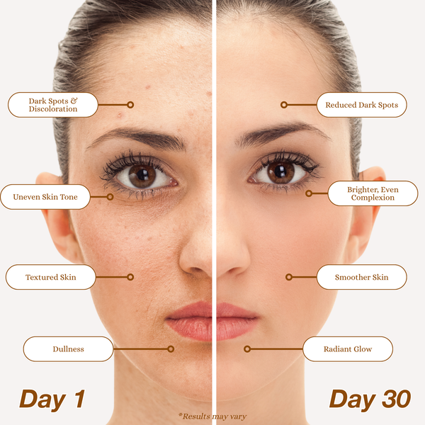 24/7 Dark Spot Correcting System