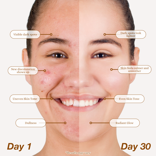 3-Step Dark Spot Routine